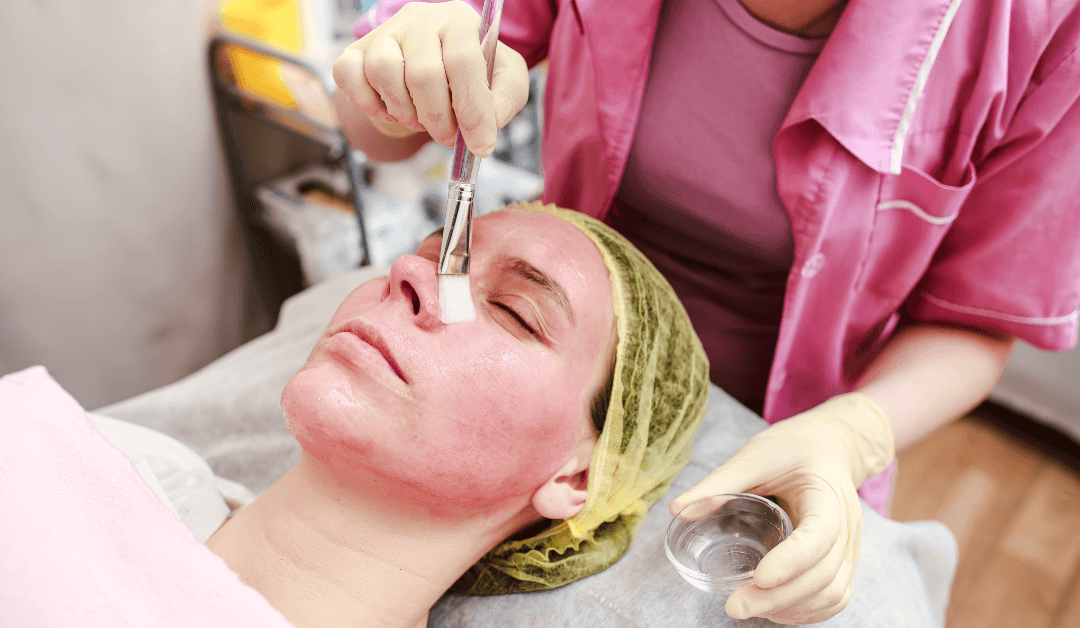 Professional Skincare Services in Frisco, skin escape by zee, Chemical Peels Near Me
